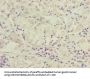 SLC52A1 Antibody