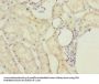 MRPL22 Antibody