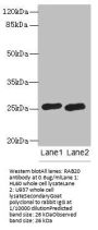 RAB20 Antibody