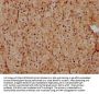 PSENEN Antibody