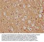 HACD3 Antibody