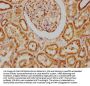 HACD3 Antibody