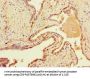 DNAH1 Antibody
