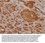 WDR35 Antibody