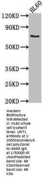 LRIT1 Antibody