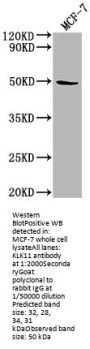 KLK11 Antibody
