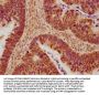 TJP2 Antibody