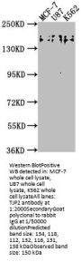 TJP2 Antibody