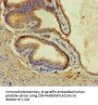 CORO1B Antibody