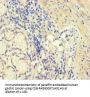 CORO1B Antibody