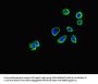 CORO1B Antibody