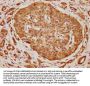 SH2D3A Antibody