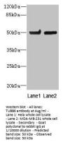 TUBB6 Antibody