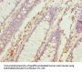 TUBB6 Antibody
