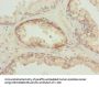 TUBB6 Antibody