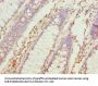 TUBB6 Antibody