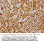 EFHD1 Antibody