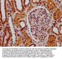 SSBP3 Antibody