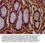 AMN Antibody