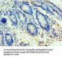 Rabbit anti-human ULBP2 polyclonal Antibody