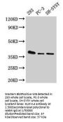 ELOVL4 Antibody