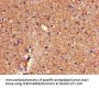 RBM38 Antibody