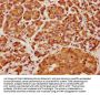 KIF13A Antibody