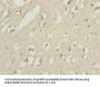MAP1LC3A Antibody