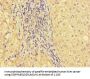 GBA2 Antibody