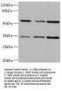 IL17RB Antibody