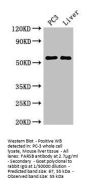 FARSB Antibody