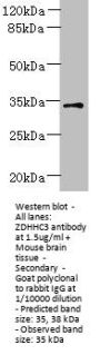 ZDHHC3 Antibody