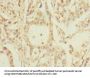 PKD2L2 Antibody