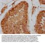 VPS18 Antibody