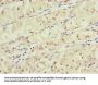 KANSL3 Antibody