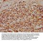 REV1 Antibody