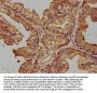 ZRANB1 Antibody