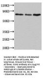 SUN2 Antibody