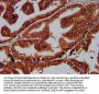 SUN2 Antibody