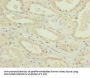 NDUFA12 Antibody