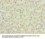 NDUFA12 Antibody
