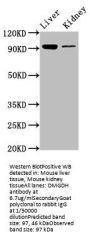 DMGDH Antibody