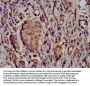 SCN11A Antibody