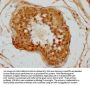 CTNNA3 Antibody