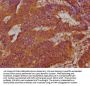 DUSP13 Antibody