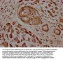 KIF25 Antibody