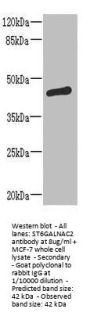 ST6GALNAC2 Antibody