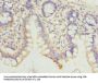 HDHD3 Antibody