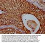 TBCD Antibody