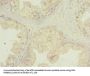 FNDC11 Antibody